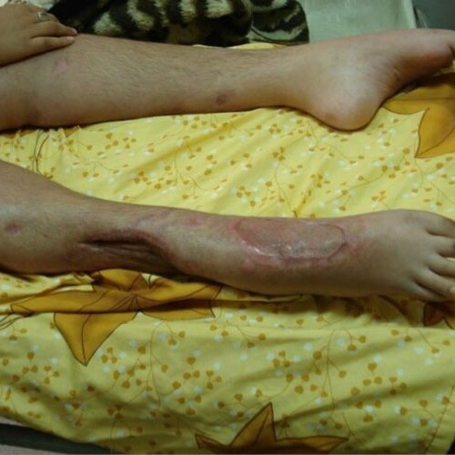 Neglected Trauma